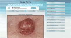 Desktop Screenshot of basalcellpictures.com